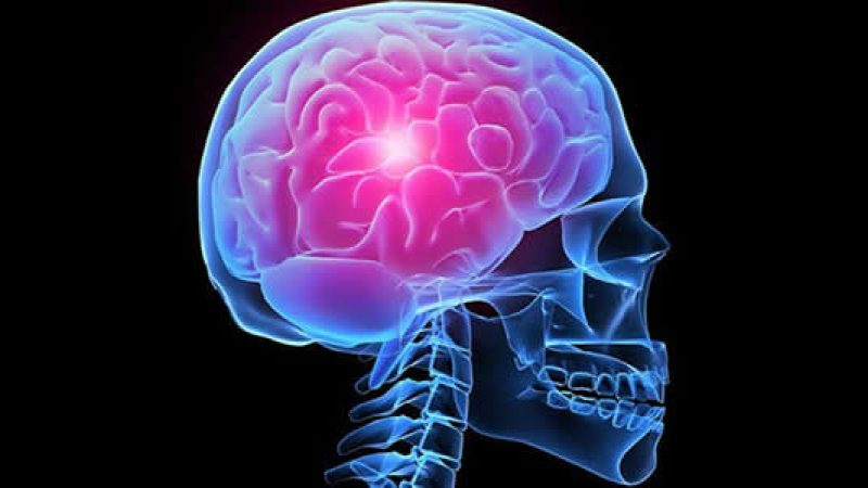 Raccomandazione civica per la gestione dei pazienti colpiti da ictus