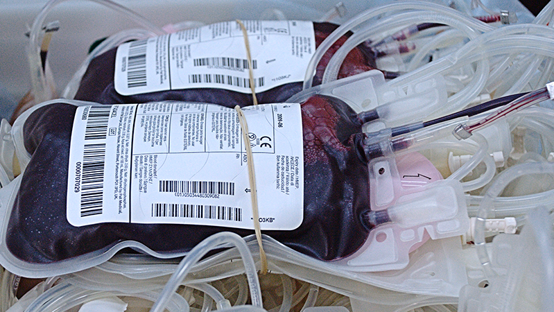 trasfusioni di sangue